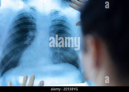 Eine Pneumologin hält eine Lungenscan in ihren Händen. Stockfoto