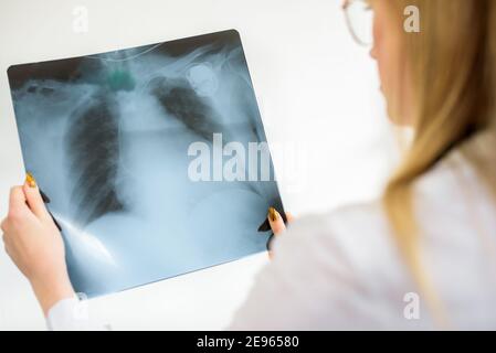 Ein junger Arzt wird eine Momentaufnahme der Lunge löschen. Diagnose von Lungenentzündung oder Tuberkulose. Röntgenuntersuchung des Patienten. Stockfoto