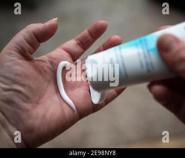 lady Anwendung Handcreme auf sehr trockene Hände verursacht durch Überschüssiges Waschen während der covid 19 Pandemie Stockfoto