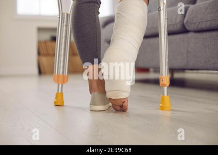Nahaufnahme des Beins einer Frau mit einem gebrochenen Bein in einem Cast, der mit Krücken im Wohnzimmer läuft. Stockfoto