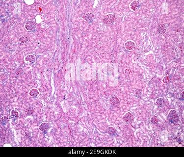 Mikrograph mit geringer Vergrößerung, der mehrere Glomeruli und gewundene Tubuli im Kortex einer menschlichen Niere zeigt. In der Mitte des Bildes befindet sich ein m Stockfoto