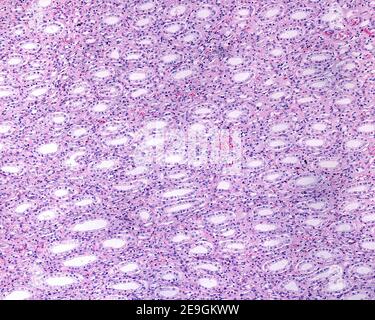 Mikrograph mit geringer Vergrößerung, der das Medullar einer menschlichen Niere zeigt. Die großen Sammelkanäle sind als Papillargänge von Bellini bekannt. Stockfoto