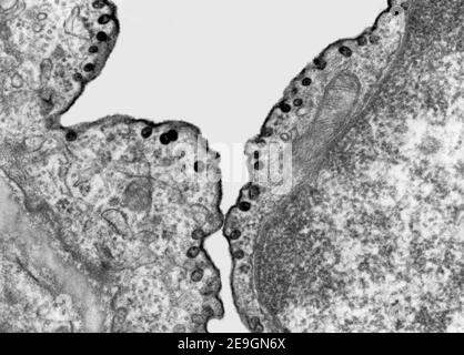 Transmissions-Elektronenmikroskop (TEM)-Mikrograph, der die Markierung von Vesikeln der Pinocytose mit einem elektronendichten Marker, dem Ruthenium-Rot, zeigt. Stockfoto