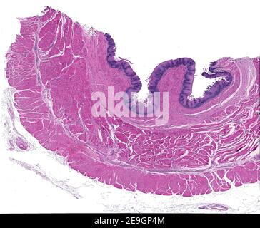 Mikrograph mit geringer Vergrößerung, der die Wandschichten einer menschlichen Speiseröhre zeigt: Schleimhaut, Submukosa, muskuläre und Adventitien. Stockfoto