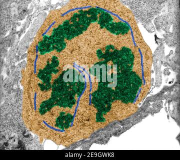 Falsche Farbe TEM-Mikrograph einer mitotischen Zelle in Prometaphase Stadium mit Chromosomen (grün) und Resten der Kernhülle Stockfoto