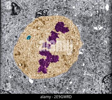Mikrograph des Transmissionselektronenmikroskops (TEM). Mitotische Zelle im Metaphase-Stadium, die Chromosomen (violett) in der äquatorialen Platte zeigt Stockfoto