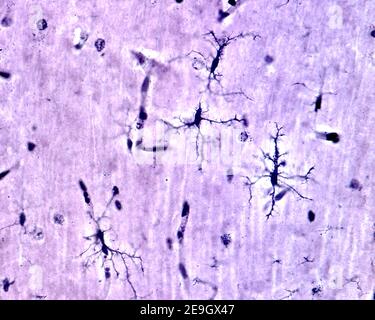 Mikroglia-Zellen, die mit der Silberkarbonat-Methode von Rio Hortega in der grauen Substanz des Gehirns gefärbt wurden. Dieser Typ ist die verzweigte oder 'resting' Mikroglia Stockfoto