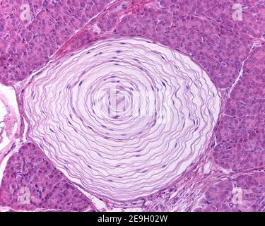 Pacinian corpuscle in einer Katze Bauchspeicheldrüse. Es hat eine dicke Kapsel in konzentrischen Lamellen organisiert. Der rosa Mittelpunkt ist die Nervenfaser Stockfoto