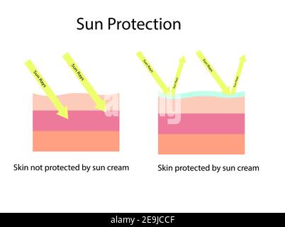Haut vergleichen zwischen der Haut mit Breitband-Sonnenschutzmittel schützen beide UVA Und UVB und normale Sonnenschutz, die nicht schützen können UVA Stock Vektor