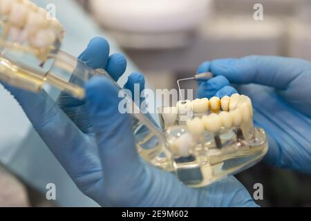 Nahaufnahme des Zahnarztes mit Zahnvorbildprothese, zeigt, wie Pulpitis aussieht Stockfoto