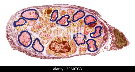 Peripherer Nerv, TEM Stockfoto