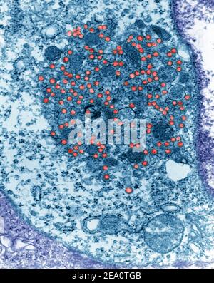 Maus Mammatumor Virus, TEM Stockfoto