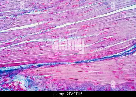 Menschlicher glatter Muskel, leichte Mikrograph Stockfoto