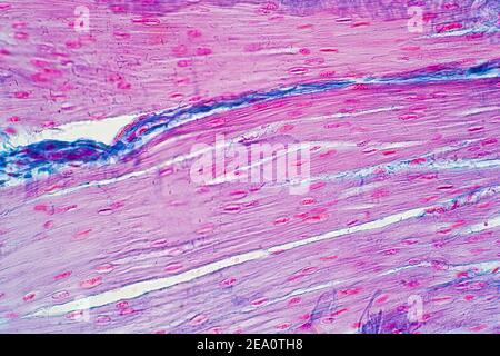 Menschlicher glatter Muskel, leichte Mikrograph Stockfoto