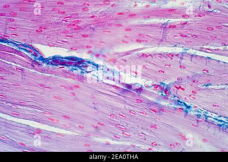 Menschlicher glatter Muskel, leichte Mikrograph Stockfoto