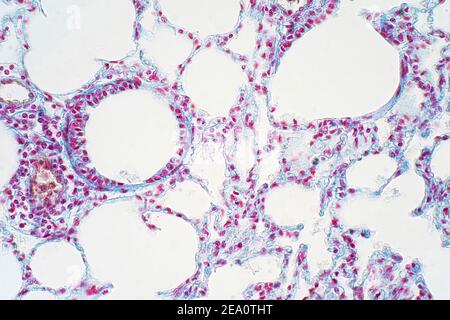 Menschliches Lungengewebe, leichte Mikrograph Stockfoto