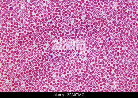 Blutzellen, leichte Mikrograph Stockfoto