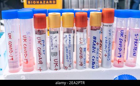 Mehrere Fläschchen von Blutproben positiv für Covid-19-Infektion der neuen Variante in Großbritannien, konzeptionelles Bild. Stockfoto