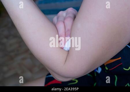 Nach der Injektion in die Vene hält die Frau einen Wattestäbchen Stockfoto