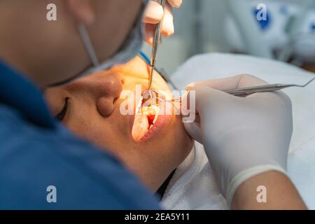 Zahnarzt mit Zahnsonde und Scaler für die Überprüfung der Zähne des Patienten. Hochwertige Fotos Stockfoto