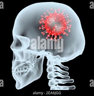Coronavirus-Krankheit COVID-19 Virusinfektion im menschlichen Gehirn, 3D Abbildung Stockfoto