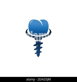 Zahnimplantat Logo Designs Konzept Vektor, Dental Care Logo Vorlage. Zahnimplantat Logo Zähne Zahn Vektor-Symbol Stock Vektor