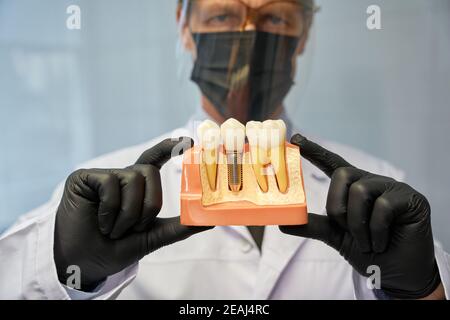 Ernsthafter Zahnarzt zeigt ein Zahnmodell mit Implantat zur Kamera Stockfoto
