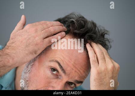 Mann Überprüft Seinen Haarausfall Stockfoto