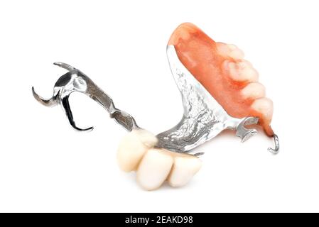Abnehmbare Teilprothese Stockfoto