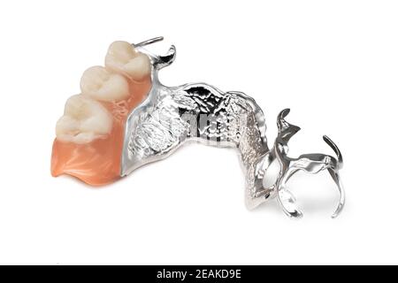 Abnehmbare Teilprothese Stockfoto