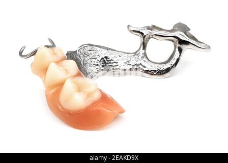 Abnehmbare Teilprothese Stockfoto