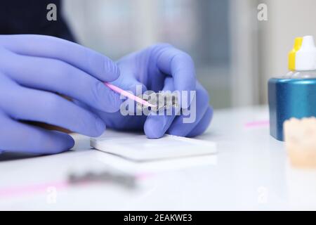 Anbringen der Klebstoffzusammensetzung auf neue Klammern.Installation von Klammern für die Ausrichtung des Gebisses oder Biss. Nicht erkennbare Person. Hände in Schutzhandschuhen. Stockfoto