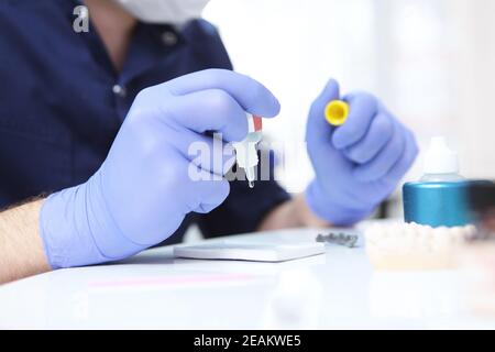 Der Zahnarzt hält eine Flasche Klebstoff für die Installation von Zahnspangen. Ausrichtung des Gebisses oder Bisses. Das Konzept der Gesundheit. Stockfoto