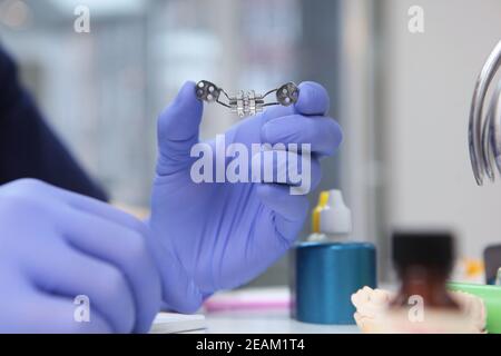 Die Installation von Zahnspangen. Kieferorthopädische Zahnspangen. Ausrichtung des Gebisses oder Bisses. Nicht erkennbare Person. Hände in Schutzhandschuhen. Stockfoto