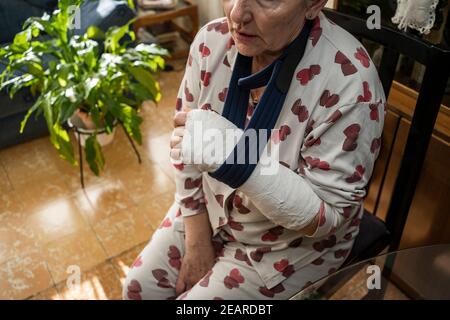 Kaukasische Erwachsene Frau mit gebrochenem Arm sitzt zu Hause Stockfoto