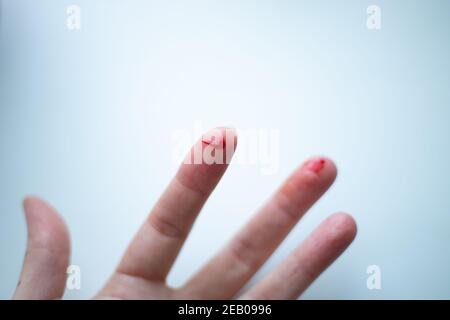 Finger auf der linken Hand ist geschnitten und blutet mit hellrotem Blut, selektiver Fokus, verschwommener Hintergrund Stockfoto