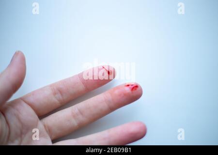 Finger auf seiner linken Hand wird geschnitten und blutet mit Helles rotes Blut auf hellem Hintergrund Stockfoto