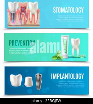 Medizinische orale Gesundheitsversorgung 3 horizontale Banner mit Prävention Stomatologie gesetzt Und Zahnimplantate Lesezeichen isoliert Vektor Illustration Stock Vektor