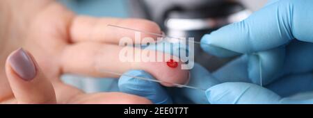 Arzt in Schutzhandschuhen berühren Tropfen Blut auf Patienten Hand mit Probenschieber Stockfoto