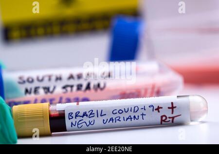 Mehrere Fläschchen von Blutproben positiv für Covid-19-Infektion der neuen Variante in Brasilien, konzeptuelles Bild. Stockfoto