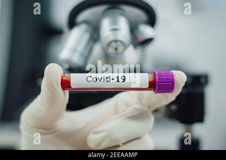 Arzt oder Wissenschaftler, die Forschung mit Blutprobenschlauch von Coronavirus oder covid-19-Krankheit für Stopp-Virus-Ausbruch-Infektion analysieren. Stockfoto