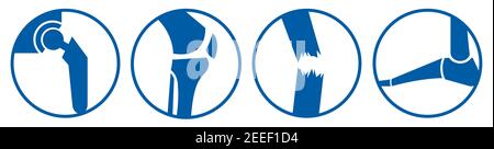 Orthopädische Knochen Teil Symbole blau - Hüfte Knie Trauma Fuß Stock Vektor