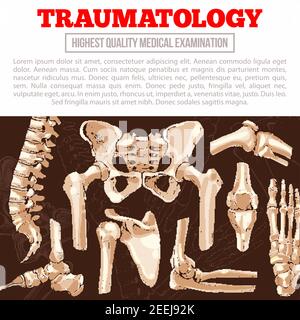 Poster-Vorlage für Traumatologie-Medizin. Knochen und Gelenk des menschlichen Skeletts Banner mit Hand und Bein, Knie, Hüfte, Fuß, Wirbelsäule, Ellbogen, Finger, Becken, Shoul Stock Vektor