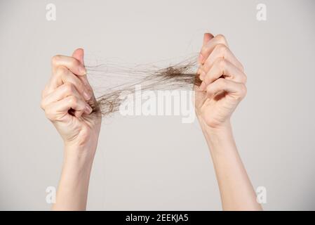 Haarausfall. Weibliche Hände mit Haarfetzen Nahaufnahme Stockfoto