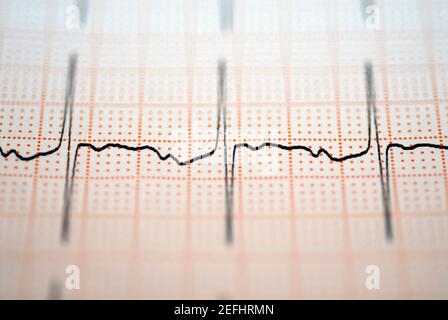 Nahaufnahme eines ECG-Berichts Stockfoto