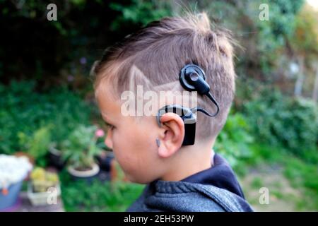 Coole Star-Form Frisur auf gehörlosen Jungen Kind 8 mit Cochlea-Implantaten Seitenansicht Profil außerhalb in Garten Wales Großbritannien KATHY DEWITT Stockfoto