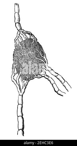 Lymphdrüse mit ihren versorgenden und entwässernden Gefäßen. Illustration des 19th. Jahrhunderts. Deutschland. Weißer Hintergrund. Stockfoto