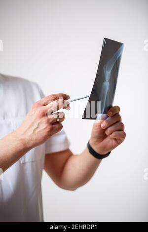 Junge männliche Arzt in einem weißen OP-Anzug hält und Untersucht ein Röntgenbild der Beinknochen des Patienten. Isoliert Auf weißem Hintergrund Stockfoto