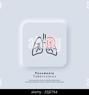 Lungen. Symbol für Lungenentzündung. Asthma oder Tuberkulose. Entzündlich in der Lunge. Vektor. UI-Symbol. Neumorphic UI UX White User Interface Web-Button. Neumorphismus Stock Vektor