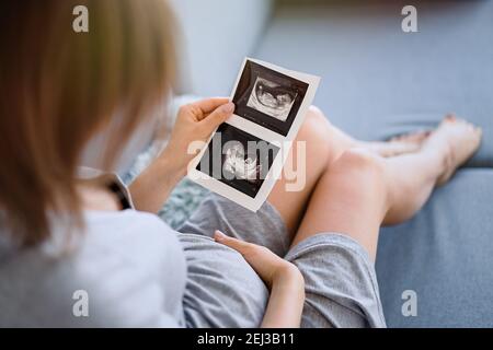 Schwangere Frau mit Ultraschalluntersuchung. Konzept der Schwangerschaft Gesundheitsversorgung Stockfoto